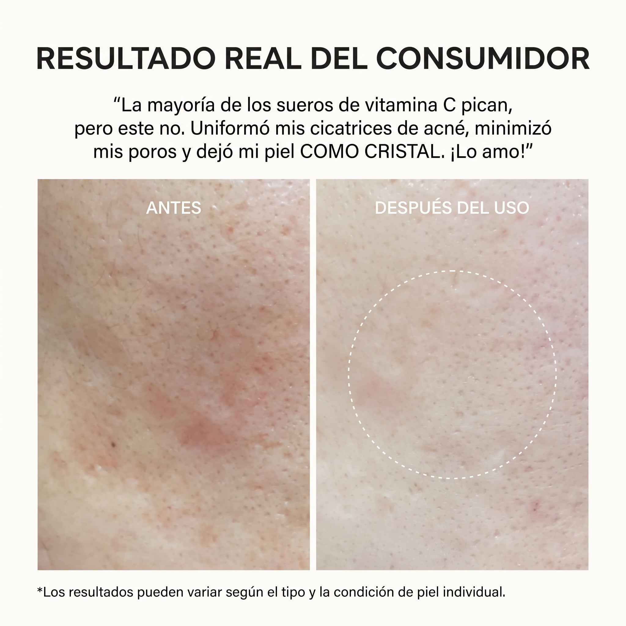 Fauren® Vitamina C Glutatión Antimanchas